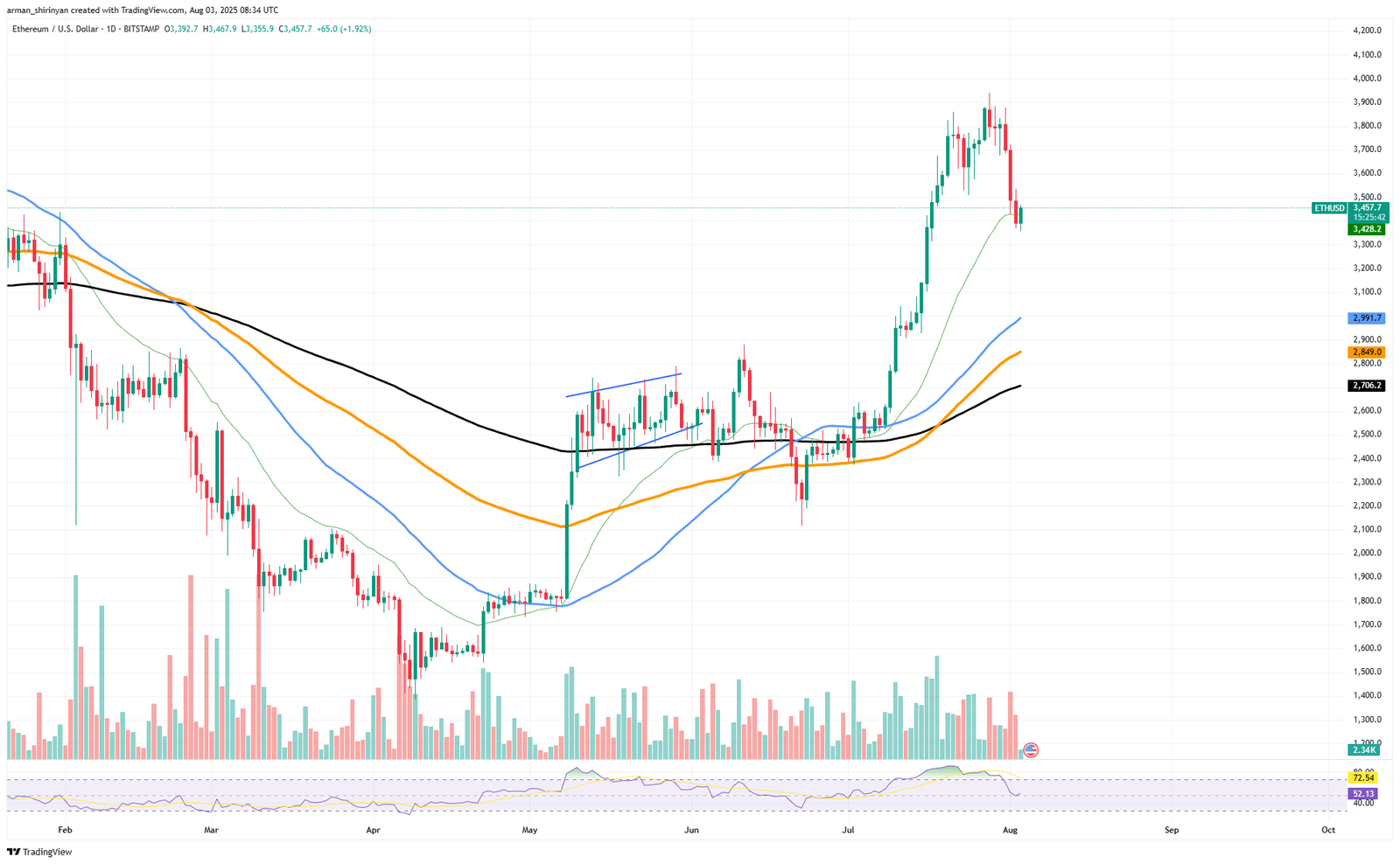 Ethereum May Find Support Amid Multi-Level Moving Averages Despite Recent Price Correction